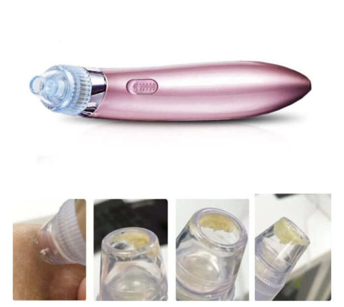 Super Clean Skin Removedor de Cravos Elétricos - Imagem 6